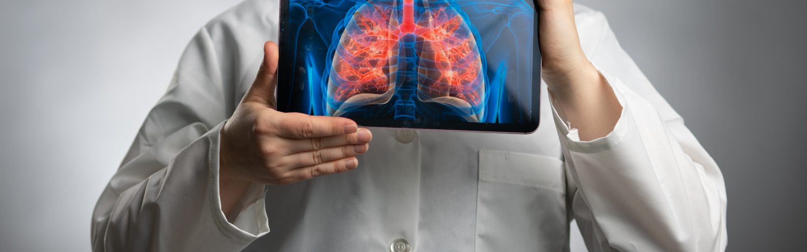 A stock image of a doctor holding up a tablet with a computer generated image of lungs on it.
